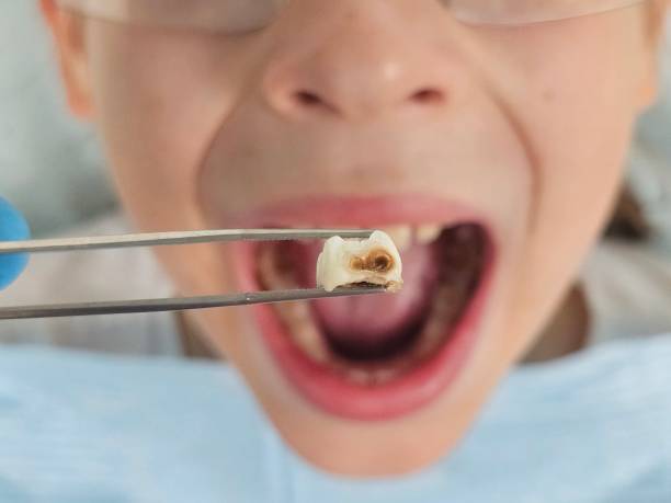 Best Pediatric Emergency Dentist in Flora Vista, NM